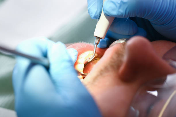 Best Broken Tooth Emergency  in Rockford, MN